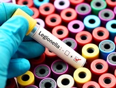 Počet lidí nakažených bakterií Legionellou každým rokem stoupá